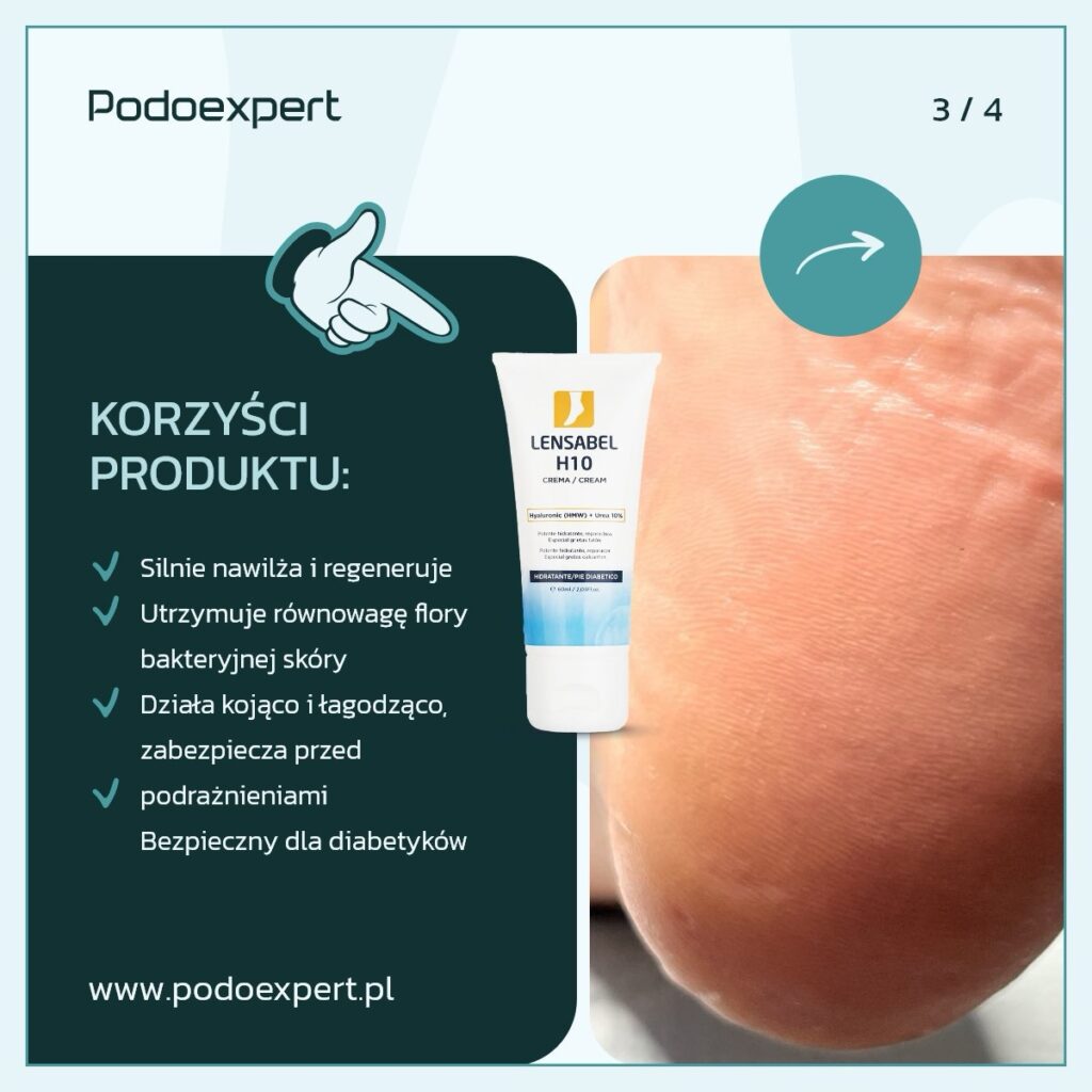 H10 krem do stóp z mocznikiem Lensa