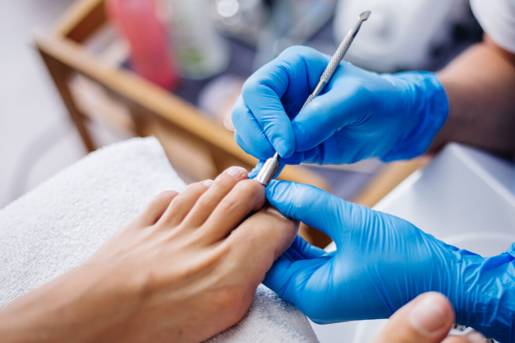 pedicure medyczny